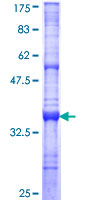 DYM Protein - 12.5% SDS-PAGE Stained with Coomassie Blue.