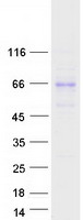DYM Protein - Purified recombinant protein DYM was analyzed by SDS-PAGE gel and Coomassie Blue Staining