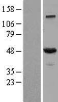 Dynactin 2 / Dynamitin Protein - Western validation with an anti-DDK antibody * L: Control HEK293 lysate R: Over-expression lysate