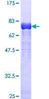 Dynactin 2 / Dynamitin Protein - 12.5% SDS-PAGE of human DCTN2 stained with Coomassie Blue