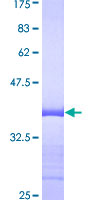 Dynactin 2 / Dynamitin Protein - 12.5% SDS-PAGE Stained with Coomassie Blue.