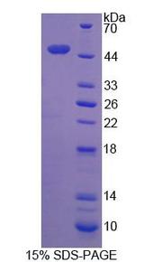 Dynactin 2 / Dynamitin Protein - Recombinant Dynactin 2 (DCTN2) by SDS-PAGE