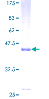 Dynactin 3 / DCTN3 Protein - 12.5% SDS-PAGE of human DCTN3 stained with Coomassie Blue