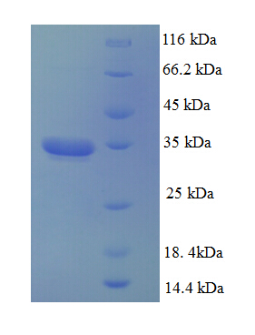 Dynactin 3 / DCTN3 Protein