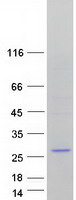 Dynactin 3 / DCTN3 Protein - Purified recombinant protein DCTN3 was analyzed by SDS-PAGE gel and Coomassie Blue Staining