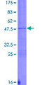 DYNC1H1 Protein - 12.5% SDS-PAGE of human DYNC1H1 stained with Coomassie Blue