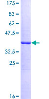 DYNC1H1 Protein - 12.5% SDS-PAGE Stained with Coomassie Blue.