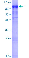 DYNC1I1 Protein - 12.5% SDS-PAGE of human DYNC1I1 stained with Coomassie Blue