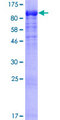 DYNC1I1 Protein - 12.5% SDS-PAGE of human DYNC1I1 stained with Coomassie Blue