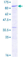 DYNC1I2 / IC2 Protein - 12.5% SDS-PAGE of human DYNC1I2 stained with Coomassie Blue