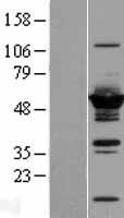 DYNC1LI2 Protein - Western validation with an anti-DDK antibody * L: Control HEK293 lysate R: Over-expression lysate