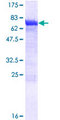 DYNC1LI2 Protein - 12.5% SDS-PAGE of human DYNC1LI2 stained with Coomassie Blue