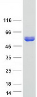DYNC1LI2 Protein - Purified recombinant protein DYNC1LI2 was analyzed by SDS-PAGE gel and Coomassie Blue Staining