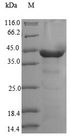 DYNC2LI1 / D2LIC Protein - (Tris-Glycine gel) Discontinuous SDS-PAGE (reduced) with 5% enrichment gel and 15% separation gel.
