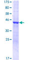 DYNC2LI1 / D2LIC Protein - 12.5% SDS-PAGE of human DYNC2LI1 stained with Coomassie Blue