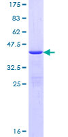 DYNLL1 / PIN Protein - 12.5% SDS-PAGE of human DYNLL1 stained with Coomassie Blue