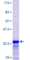 DYNLL1 / PIN Protein - 12.5% SDS-PAGE Stained with Coomassie Blue.