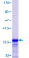 DYNLL1 / PIN Protein - 12.5% SDS-PAGE Stained with Coomassie Blue.