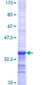DYNLL2 Protein - 12.5% SDS-PAGE Stained with Coomassie Blue.