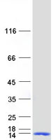 DYNLL2 Protein - Purified recombinant protein DYNLL2 was analyzed by SDS-PAGE gel and Coomassie Blue Staining