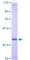 DYNLRB1 Protein - 12.5% SDS-PAGE of human DNCL2A stained with Coomassie Blue