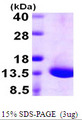 DYNLT1 / TCTEX-1 Protein