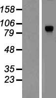 DYRK / DYRK1A Protein - Western validation with an anti-DDK antibody * L: Control HEK293 lysate R: Over-expression lysate