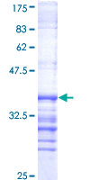 DYRK / DYRK1A Protein - 12.5% SDS-PAGE Stained with Coomassie Blue.
