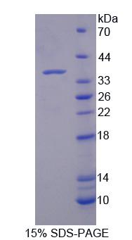 DYRK / DYRK1A Protein - Recombinant  Dual Specificity Tyrosine Phosphorylation Regulated Kinase 1A By SDS-PAGE