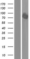 DYRK1B Protein - Western validation with an anti-DDK antibody * L: Control HEK293 lysate R: Over-expression lysate
