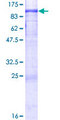DYRK1B Protein - 12.5% SDS-PAGE of human DYRK1B stained with Coomassie Blue