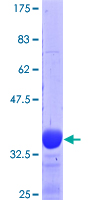 DYRK1B Protein - 12.5% SDS-PAGE Stained with Coomassie Blue.
