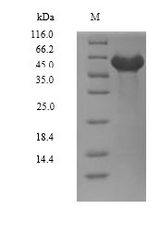 DYRK2 Protein - (Tris-Glycine gel) Discontinuous SDS-PAGE (reduced) with 5% enrichment gel and 15% separation gel.