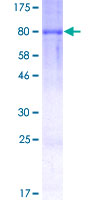 DYRK2 Protein - 12.5% SDS-PAGE of human DYRK2 stained with Coomassie Blue