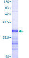 DYRK2 Protein - 12.5% SDS-PAGE Stained with Coomassie Blue.