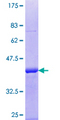 DYRK3 Protein - 12.5% SDS-PAGE Stained with Coomassie Blue.
