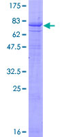 DYRK4 Protein - 12.5% SDS-PAGE of human DYRK4 stained with Coomassie Blue