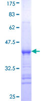 DYRK4 Protein - 12.5% SDS-PAGE Stained with Coomassie Blue.