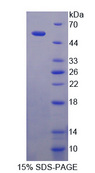 Dysferlin Protein - Recombinant Dysferlin By SDS-PAGE