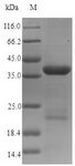 Dystonin / BPAG1 Protein - (Tris-Glycine gel) Discontinuous SDS-PAGE (reduced) with 5% enrichment gel and 15% separation gel.