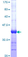 Dystonin / BPAG1 Protein - 12.5% SDS-PAGE Stained with Coomassie Blue.