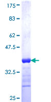 DYX1C1 Protein - 12.5% SDS-PAGE Stained with Coomassie Blue.