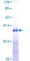 DZIP1 Protein - 12.5% SDS-PAGE Stained with Coomassie Blue.