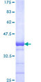 DZIP3 Protein - 12.5% SDS-PAGE Stained with Coomassie Blue.