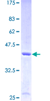 E-FABP / FABP5 Protein - 12.5% SDS-PAGE of human FABP5 stained with Coomassie Blue