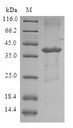 E-FABP / FABP5 Protein - (Tris-Glycine gel) Discontinuous SDS-PAGE (reduced) with 5% enrichment gel and 15% separation gel.