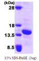 E-FABP / FABP5 Protein