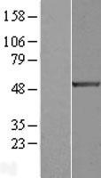 E2F1 Protein - Western validation with an anti-DDK antibody * L: Control HEK293 lysate R: Over-expression lysate