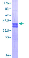 E2F1 Protein - 12.5% SDS-PAGE Stained with Coomassie Blue.