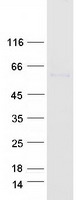 E2F1 Protein - Purified recombinant protein E2F1 was analyzed by SDS-PAGE gel and Coomassie Blue Staining